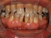 Konig Center for Cosmetic & Comprehensive Dentistry smile photos